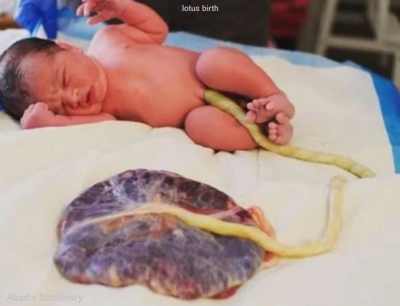 lotus birth